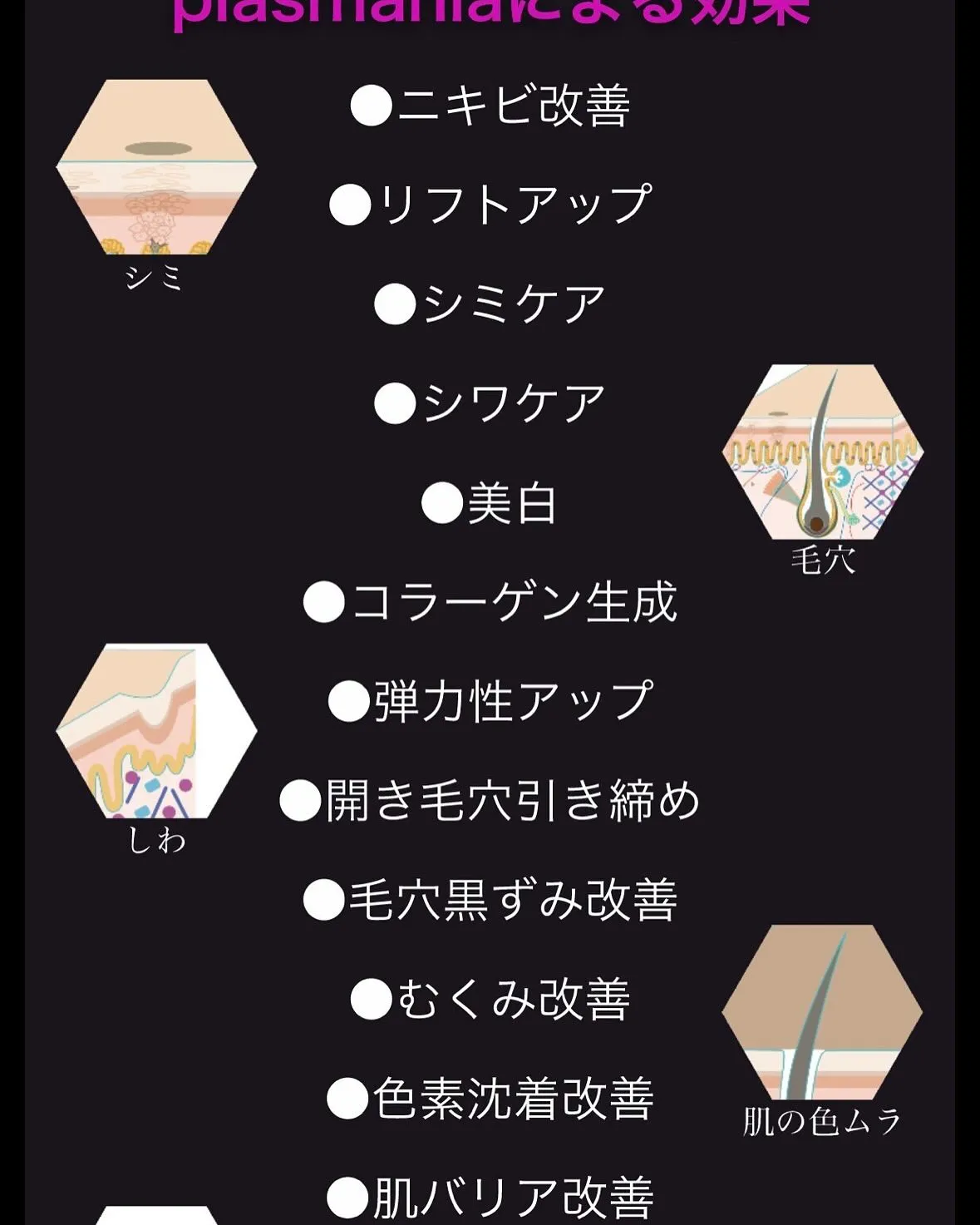 本日も、プラズマニアの施術で喜んでいただけました❣️