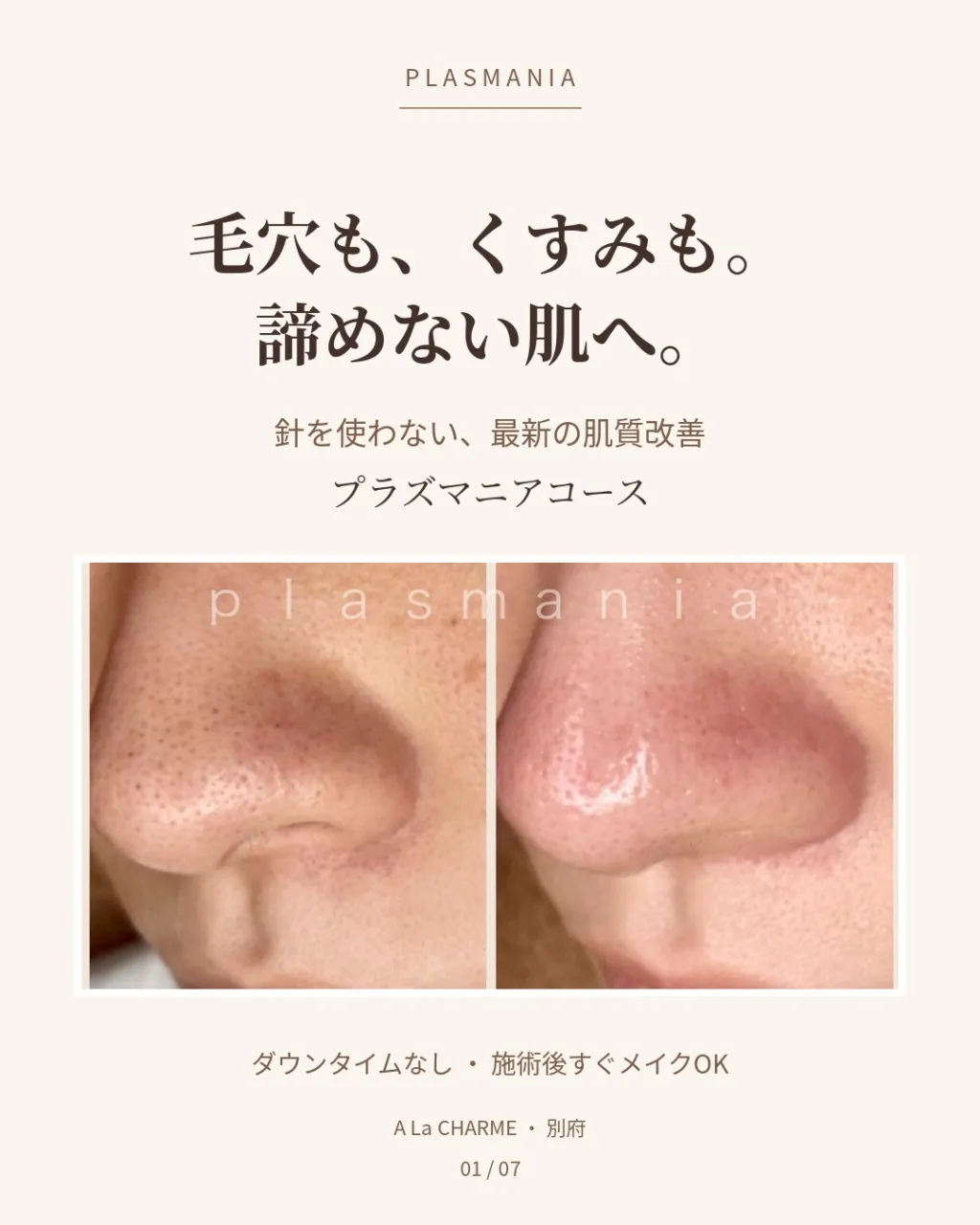 毛穴も、くすみも。